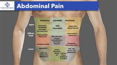 www aoins com|what is oain pain.